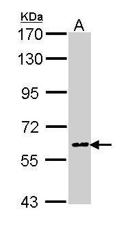 Anti-COX1 antibody used in Western blot. GTX113259