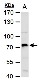 Anti-COX1 antibody used in Western blot. GTX113259