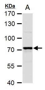 Anti-COX1 antibody used in Western blot. GTX113259