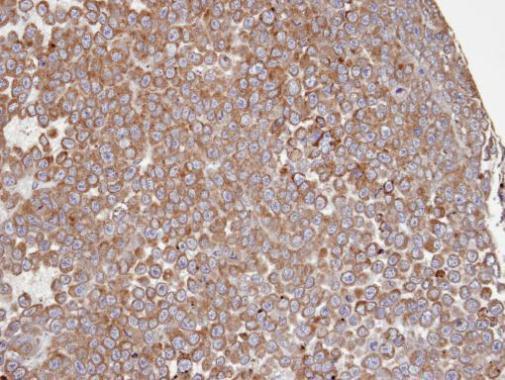 Anti-COX1 antibody [C3], C-term used in IHC (Formalin-fixed paraffin-embedded sections). GTX104634