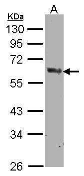 Anti-COX1 antibody [C3], C-term used in Western blot. GTX104634