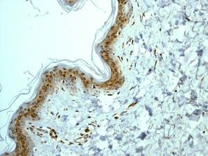 Anti-COX1 antibody [EPR5866] used in IHC (Formalin-fixed paraffin-embedded sections). GTX63375
