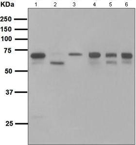 Anti-COX1 antibody [EPR5866] used in Western blot. GTX63375