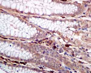 Anti-COX1 antibody [EPR5867] used in IHC (Formalin-fixed paraffin-embedded sections). GTX63493