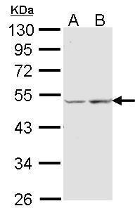 Anti-COX15 antibody [N1C1] used in Western blot. GTX102999