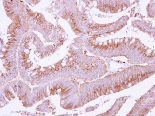 Anti-COX15 antibody [N3C3] used in IHC (Formalin-fixed paraffin-embedded sections). GTX115022