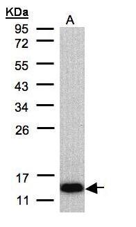 Anti-COX6A2 antibody [N3C3] used in Western blot. GTX108261