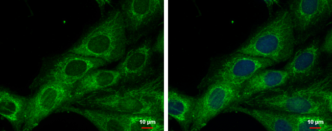Anti-COX6A2 antibody [N3C3] used in ICC/IF. GTX108261
