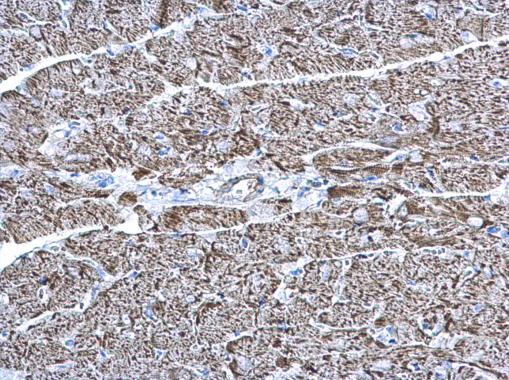 Anti-COX6A2 antibody [N3C3] used in IHC (Formalin-fixed paraffin-embedded sections). GTX108261