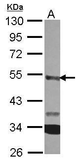 Anti-CPA3 antibody [N3C3] used in Western blot. GTX119049