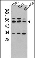 Anti-CPA4 antibody, C-term used in Western blot. GTX81517