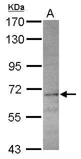 Anti-CPNE4 antibody used in Western blot. GTX119671