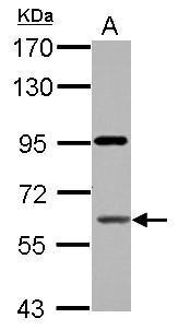 Anti-CPNE4 antibody used in Western blot. GTX119671