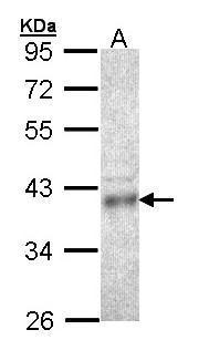 Anti-CPOX antibody [N2C3] used in Western blot. GTX105056