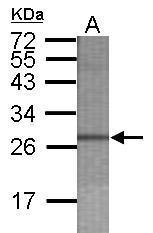 Anti-CPSF1 antibody [C1C2], Internal used in WB-Ag. GTX115895