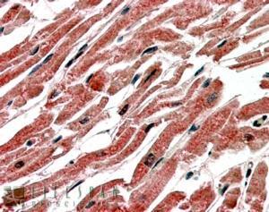 Anti-CPT1B (isoform 1) antibody, C-term used in IHC (Formalin-fixed paraffin-embedded sections). GTX15703