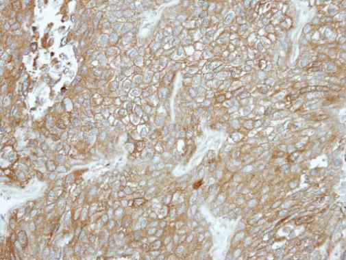 Anti-CPXM1 antibody [N3C3] used in IHC (Formalin-fixed paraffin-embedded sections). GTX119190