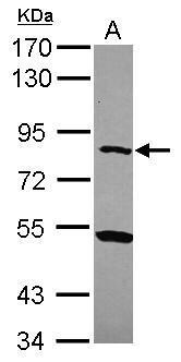 Anti-CPXM1 antibody [N3C3] used in Western blot. GTX119190