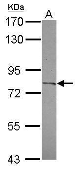 Anti-CPXM2 antibody [C2C3], C-term used in Western blot. GTX119255