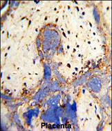 Anti-CPZ antibody, N-term used in IHC (Formalin-fixed paraffin-embedded sections). GTX81852
