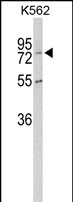 Anti-CPZ antibody, N-term used in Western blot. GTX81852