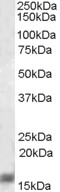 Anti-AIF1 / IBA1 (isoform 1 and 3) antibody, C-term used in Western blot. GTX89792