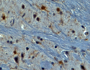 Anti-AIF1 / IBA1 (isoform 1 and 3) antibody, C-term used in IHC (Formalin-fixed paraffin-embedded sections). GTX89792