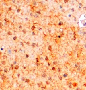 Anti-AIF1 / IBA1 (isoform 3) antibody, Internal used in IHC (Formalin-fixed paraffin-embedded sections). GTX89367