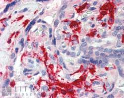 Anti-AIF1 / IBA1 (isoform 3) antibody, Internal used in IHC (Formalin-fixed paraffin-embedded sections). GTX89367