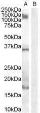 Anti-AIF1 / IBA1 (isoform 3) antibody, Internal used in Western blot. GTX89367