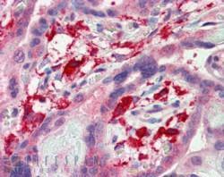 Anti-AIF1 / IBA1 (isoforms 1 + 3) antibody, C-term used in IHC (Formalin-fixed paraffin-embedded sections). GTX89048