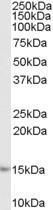 Anti-AIF1 / IBA1 (isoforms 1 + 3) antibody, C-term used in Western blot. GTX89048