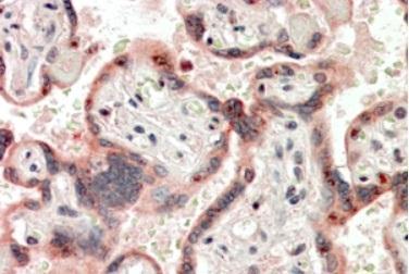 Anti-CRIPTO antibody, Internal used in Immunohistochemistry. GTX88209