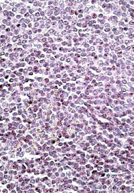 Anti-AIM2 antibody, C-term used in IHC (Formalin-fixed paraffin-embedded sections). GTX88186