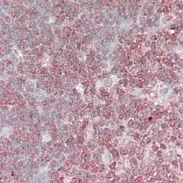 Anti-CRKL antibody, C-term used in IHC (Formalin-fixed paraffin-embedded sections). GTX89690