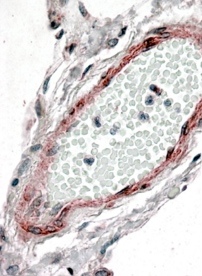 Anti-CRP2 / CSRP2 antibody, Internal used in IHC (Formalin-fixed paraffin-embedded sections). GTX88912