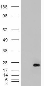 Anti-CRP2 / CSRP2 antibody, Internal used in Western blot. GTX88912