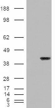 Anti-AIP / ARA9 antibody, C-term used in Western blot. GTX89023