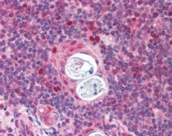 Anti-AIRE (isoforms 1 and 2) antibody, C-term used in IHC (Formalin-fixed paraffin-embedded sections). GTX13573