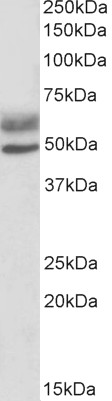 Anti-AIRE (isoforms 1 and 2) antibody, C-term used in Western blot. GTX13573