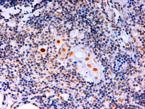 Anti-AIRE (isoforms 1 and 2) antibody, C-term used in IHC (Formalin-fixed paraffin-embedded sections). GTX13573