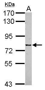 Anti-CSRP2BP antibody [N1N3] used in Western blot. GTX118397