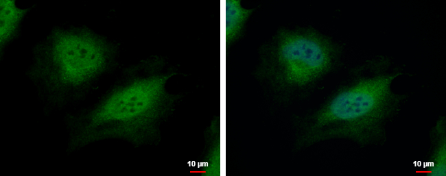 Anti-CSRP2BP antibody [N1N3] used in ICC/IF. GTX118397