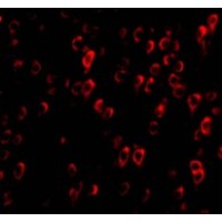 Anti-CTRP4 antibody used in ICC/IF. GTX85504
