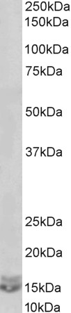 Anti-CXCL2 / MIP-2 antibody, C-term used in Western blot. GTX88379