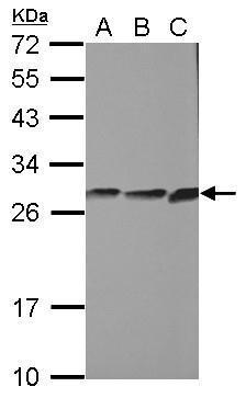 Anti-CYB5R2 antibody [N1C2] used in Western blot. GTX104417