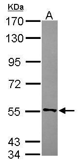 Anti-CYB5R4 antibody [C1C3] used in Western blot. GTX119151