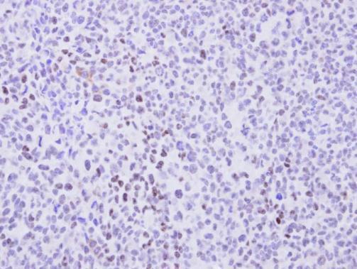 Anti-cyclin T2 antibody [C2C3], C-term used in IHC (Formalin-fixed paraffin-embedded sections). GTX111944