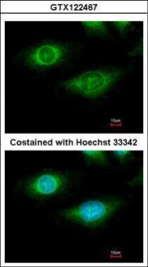 Anti-CYFIP1 antibody [N1N2], N-term used in ICC/IF. GTX122467