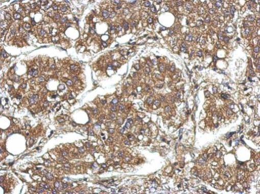 Anti-CYFIP1 antibody [N1N2], N-term used in IHC (Formalin-fixed paraffin-embedded sections). GTX122467